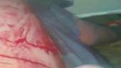 INCIDENTE. Fotograma del vídeo difundido por Canal Sur Noticias en el que se ve la herida en la pierna del maliense.