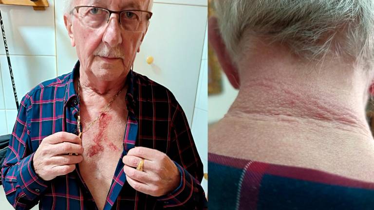 Herido un vecino de Torredonjimeno tras un intento de robo Herido un vecino de Torredonjimeno tras un intento de robo