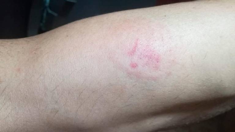 Un preso agrede a patadas y mordiscos a tres funcionarios Un preso agrede a patadas y mordiscos a tres funcionarios
