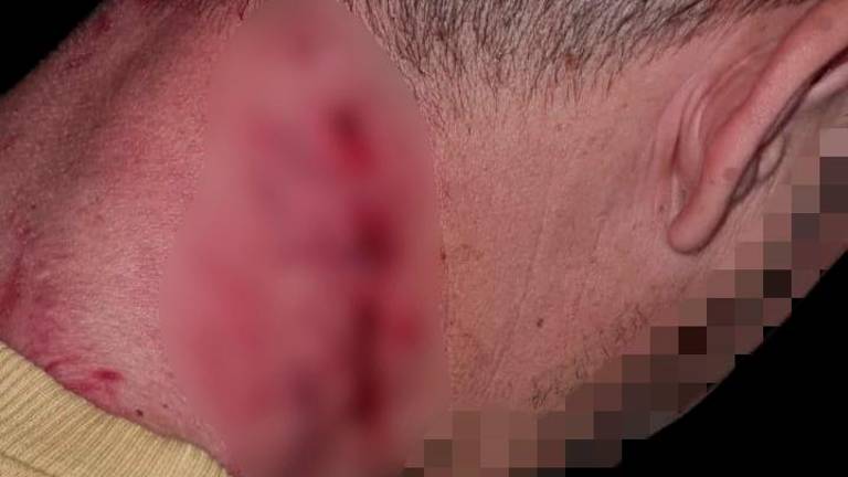 Brutal ataque de un perro peligroso a un viandante en Jaén Brutal ataque de un perro peligroso a un viandante en Jaén