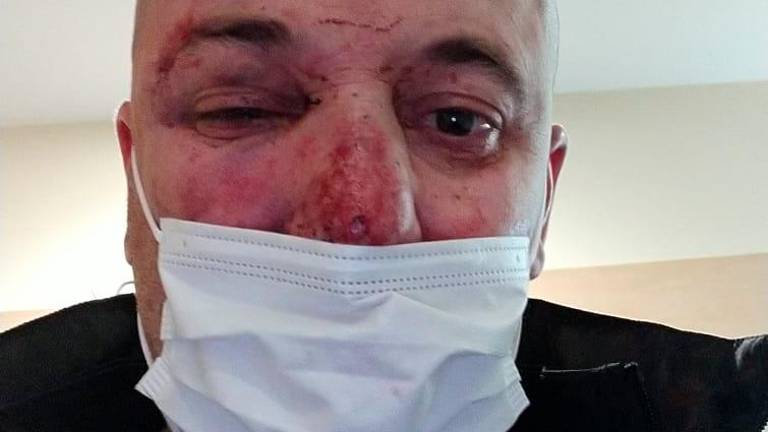 A la espera del parte médico del agredido en la brutal paliza policial en Linares A la espera del parte médico del agredido en la brutal paliza policial en Linares