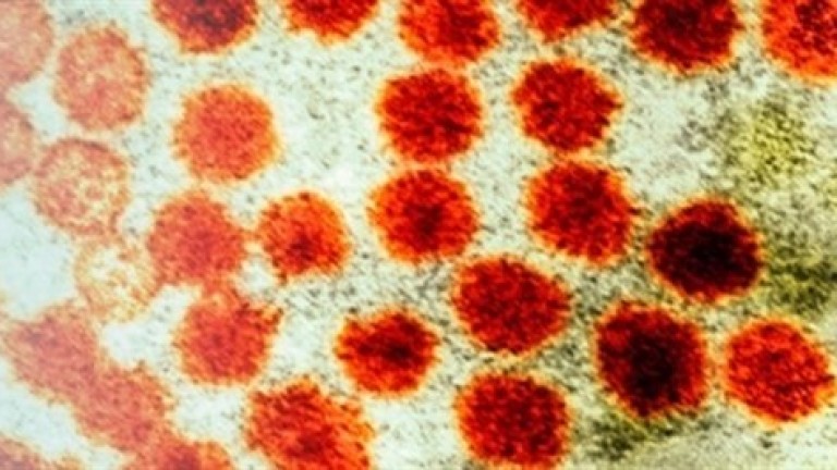 La hepatitis A repunta en Europa y se dispara en España