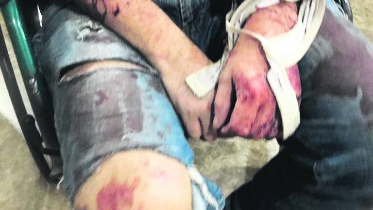 Un matrimonio es atacado por dos perros en un olivar Un matrimonio es atacado por dos perros en un olivar