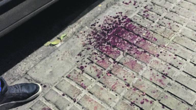 El menor que perdió la mano por un petardo, estable dentro de la gravedad El menor que perdió la mano por un petardo, estable dentro de la gravedad