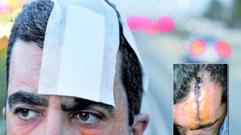 Pide ayuda para identificar al camionero que lo arrolló Pide ayuda para identificar al camionero que lo arrolló