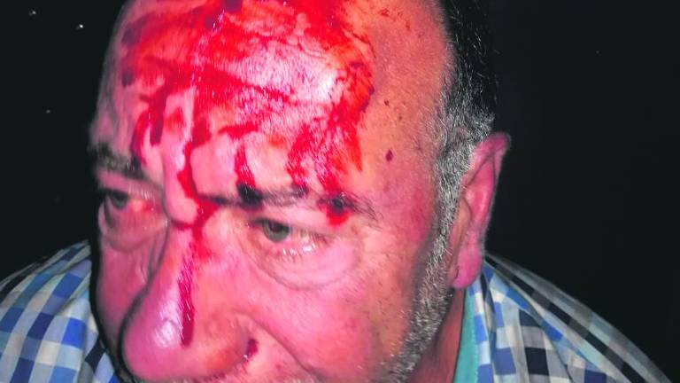 Denuncia por la agresión a un concejal de Bailén Denuncia por la agresión a un concejal de Bailén