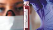 PRUEBA. Una técnico de laboratorio sostiene una muestra de sangre.