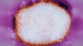 Partícula amplificada del virus de la viruela del mono / CDC.