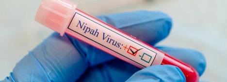 Virus Nipah. Archivo.