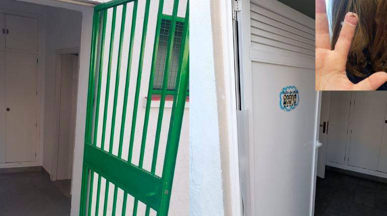 <i>A la izquierda, la puerta de hierro forjado, a la derecha, la de plástico por la que se ha cambiado, junto al dedo de la niña que fue dañado por el incidente. </i>