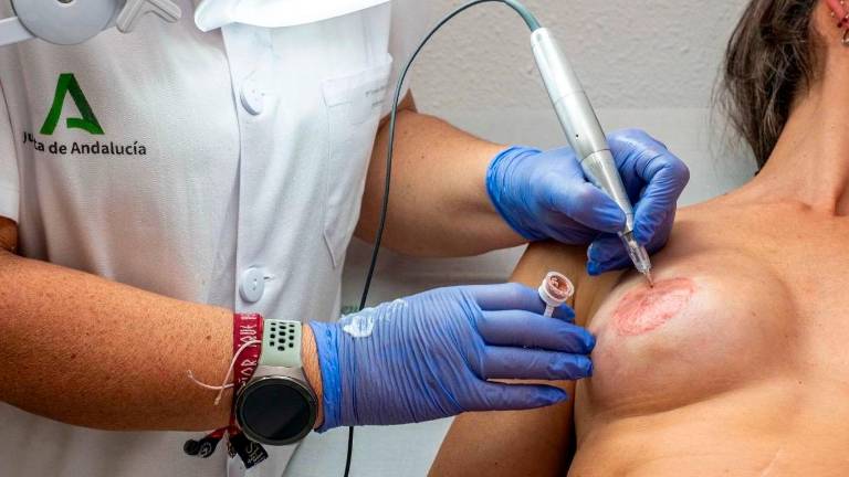 El Hospital Universitario de Jaén inicia la micropigmentación de areola mamaria