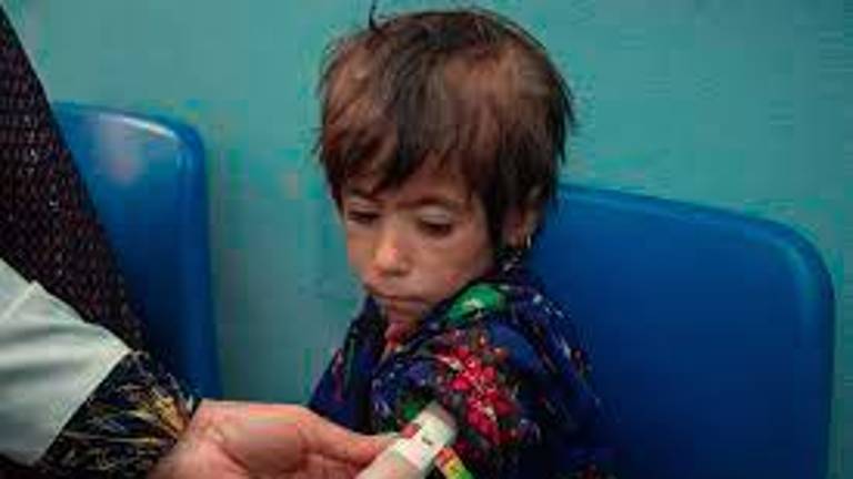 Crisis de desnutrición en Afganistán: el viaje de Parwana hacia la recuperación