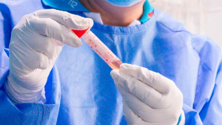 Jaén suma 63 positivos en un día