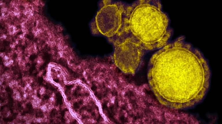 Expertos aseguran que el riesgo de casos del nuevo coronavirus en España es “muy bajo”