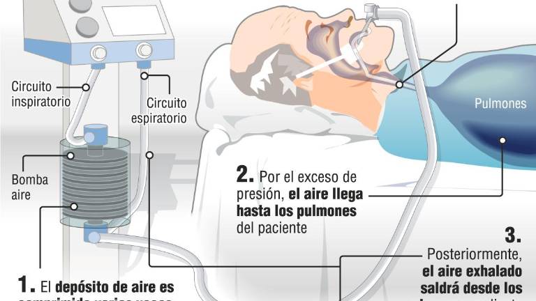 Una oportunidad para ser solidarios con las máquinas de apnea