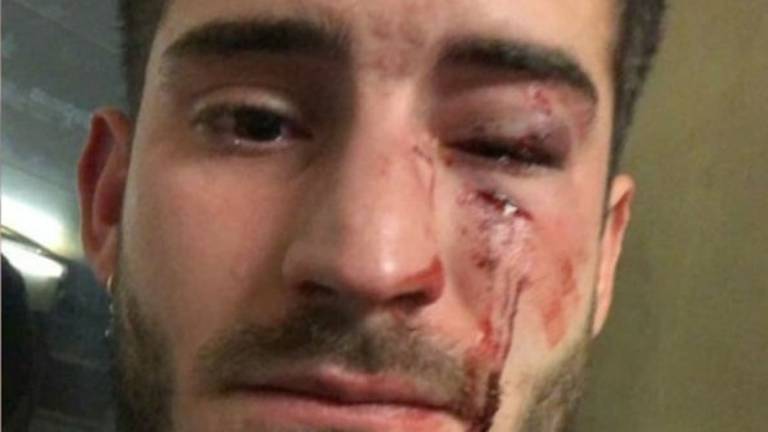 Repulsa a la agresión homófoba contra un huelmense